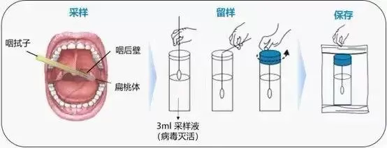 戳鼻子、捅喉咙……哪个才是正确的核酸采样方法 其中有哪些防护要点